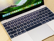 Macbook 2015 12 inch bị lỗi âm thanh